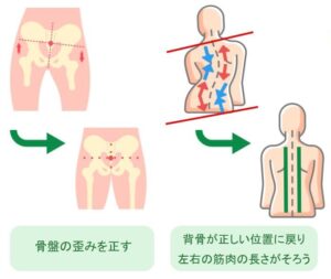 骨盤矯正の施術イメージ2